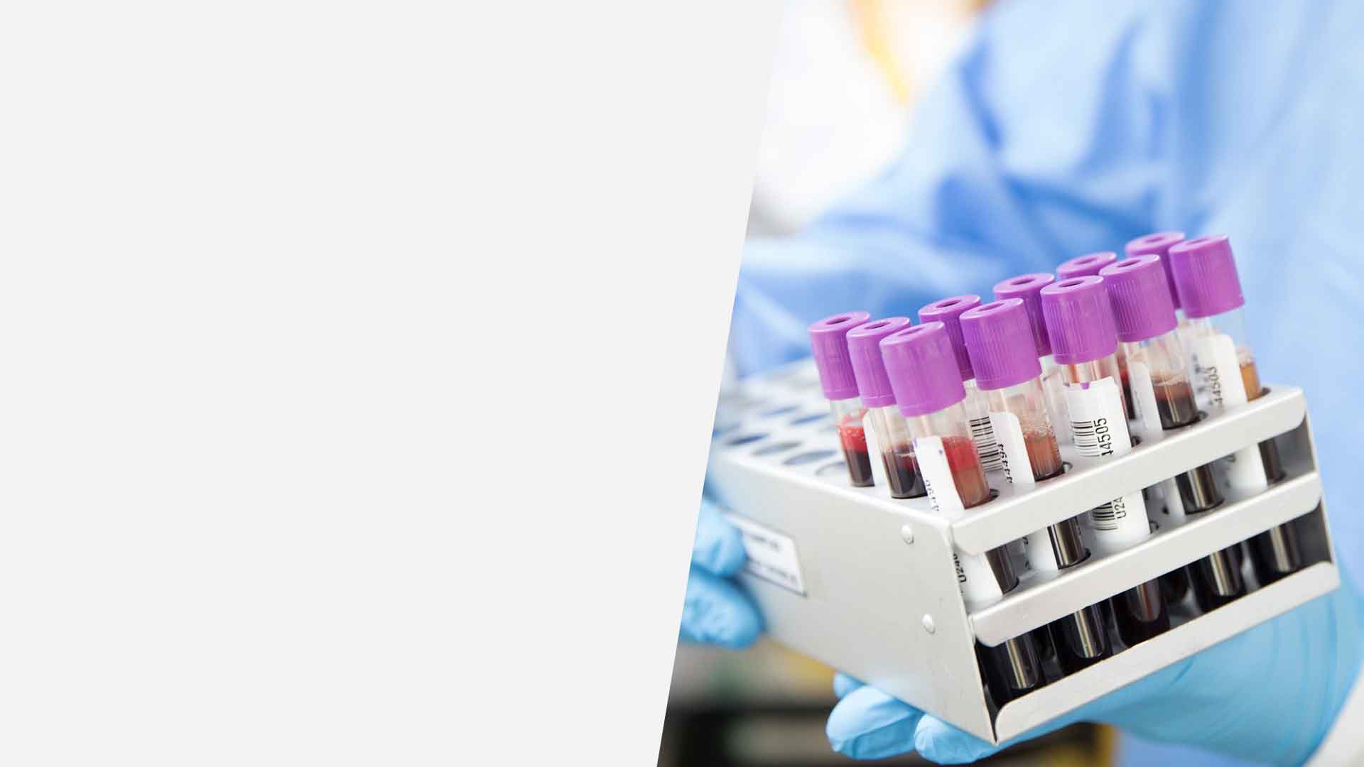 Full Body Blood Checkup